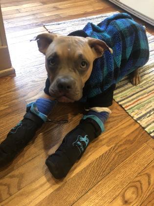 Flicka wearing casts.